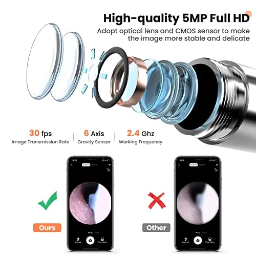 Ear Wax Removal - Wireless Ear Cleaner with 5MP HD Camera, Ear Endoscope with Lights, Ear Wax Removal Tool with 8 Cleaning Kit - Ear Wax Camera for iOS & Android Phones